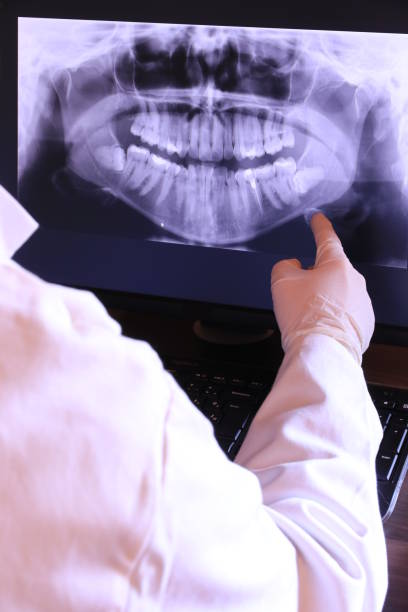 Best Emergency Dentist for Lost Fillings or Crowns in The Homesteads, TX