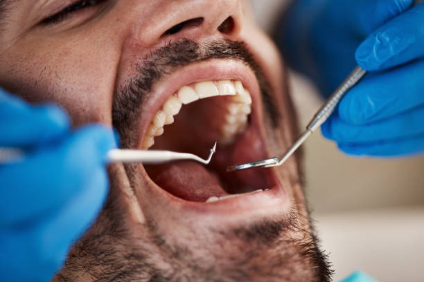 Best Emergency Dental Services for Seniors in The Homesteads, TX
